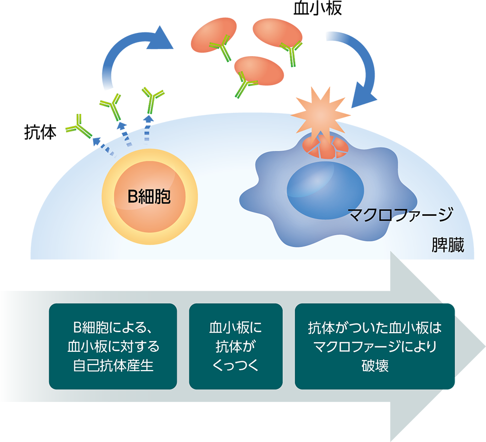 ITPの原因